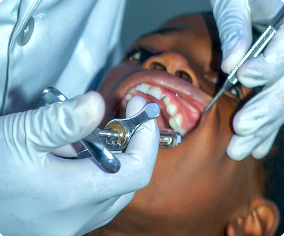 Image do procedimento de Odentopediatria